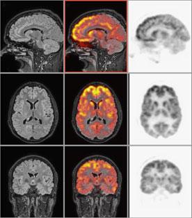 PET MRI Combined Scanner Images