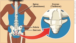 Tailbone Pain
