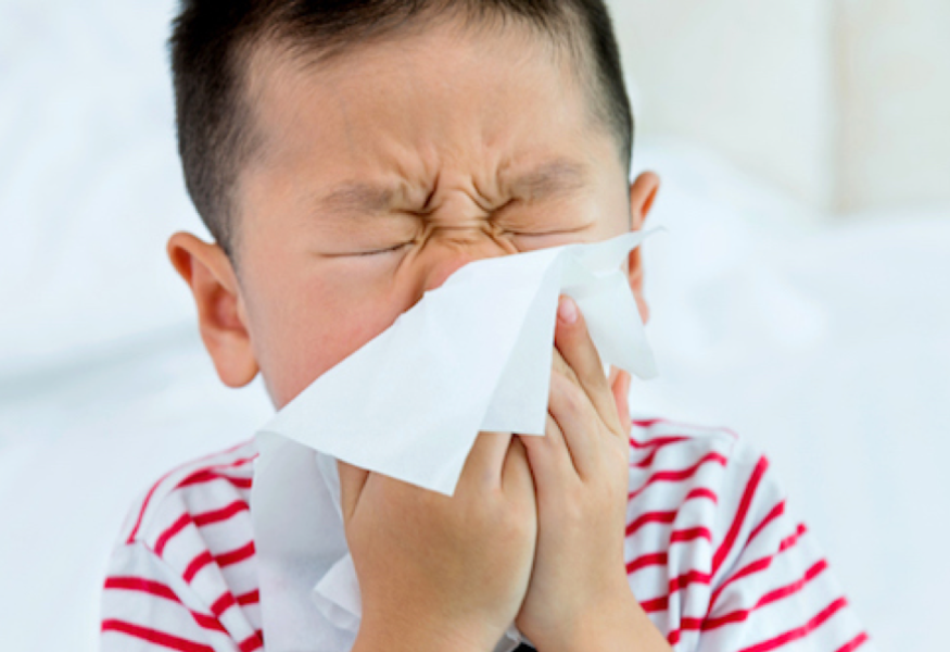 Allergies | Texas Children's Hospital 