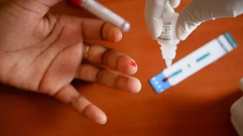 HIV Testing