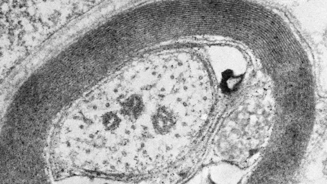 Transmission microscopic image of a sciatic nerve axon