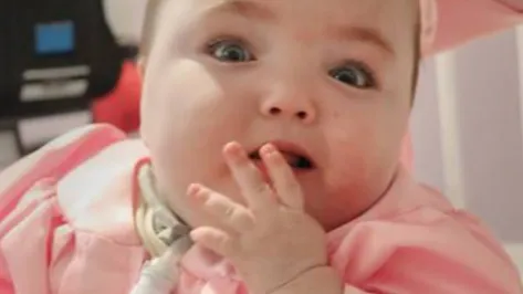 Micro Premie baby