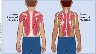 Back-Strain