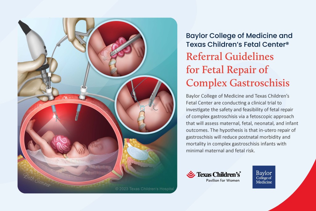 SMFM 2026 Pregnancy Meeting | Texas Children's