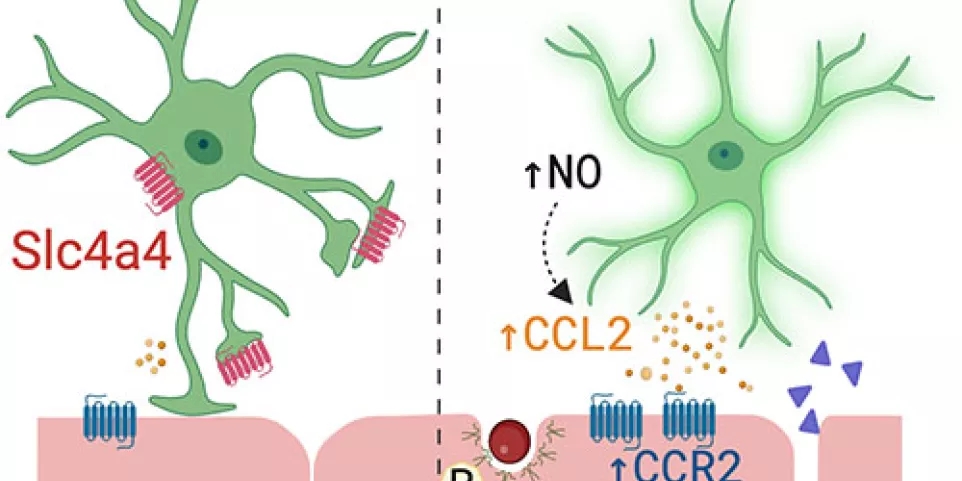Study finds the cause of brain damage due to ischemic stroke and a way ...