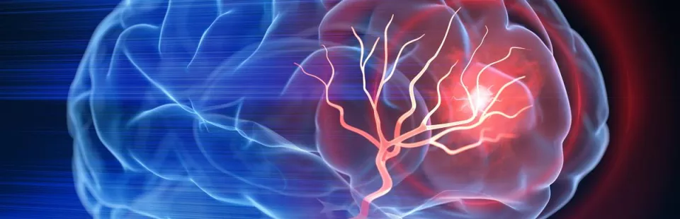 <p>Pediatric Stroke Clinic</p>