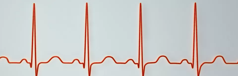 <p>Electrophysiology Program</p>