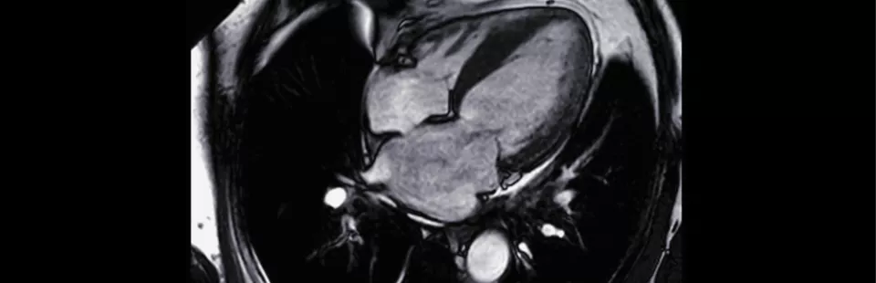 <p>Cardiac Imaging Program</p>