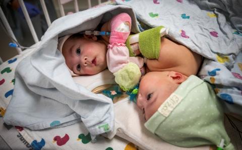 Texas Children’s Hospital Announces Homecoming for Formerly Conjoined Twin Girls Ella Grace and Eliza Faith Fuller