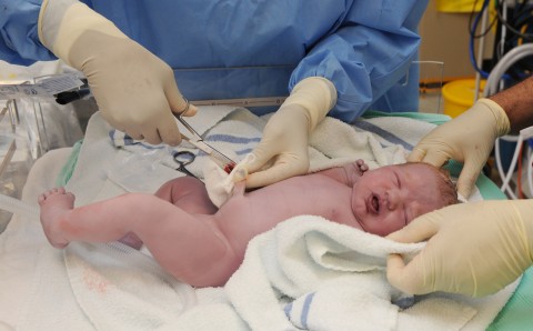 cord clamping
